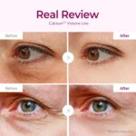 Dr.Melaxin Calcium Volume Under Eye Patches for Puffy Eyes & Dark Circles - Image 4